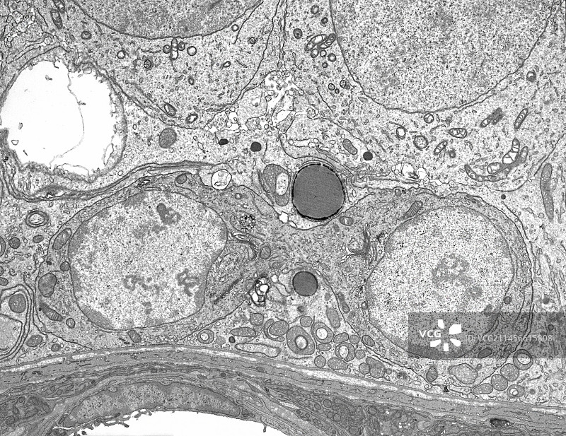 精原细胞，透射电镜图片素材