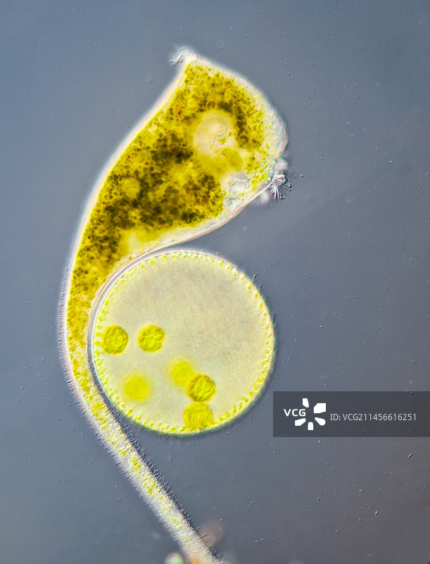 喇叭虫和Volvox藻类群落显微照片图片素材