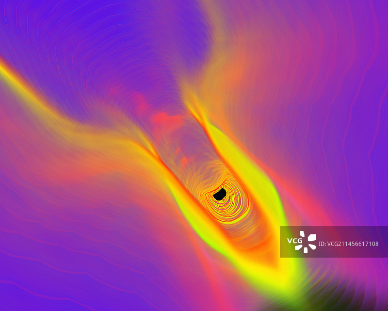 声带CT扫描图片素材