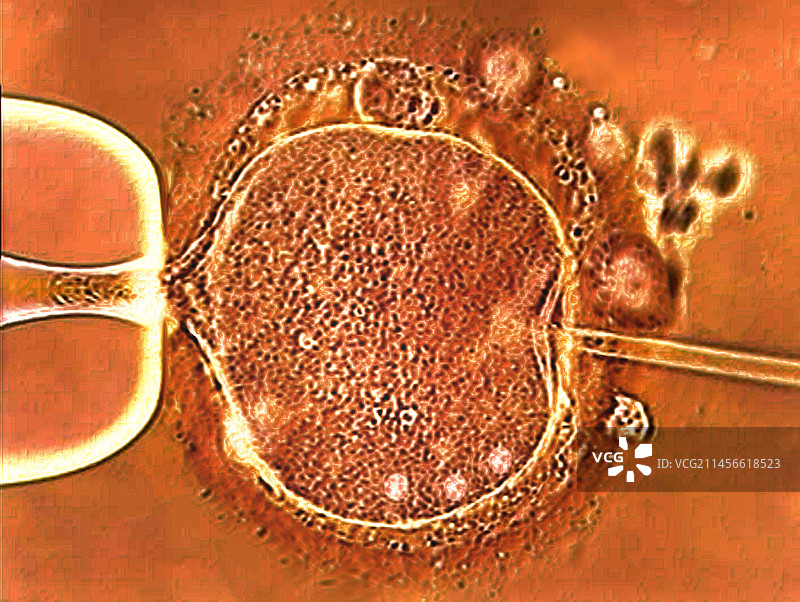 体外受精显微照片图片素材
