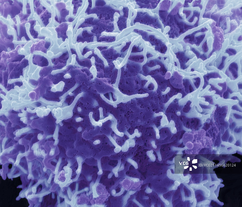 埃博拉病毒扫描电镜图图片素材