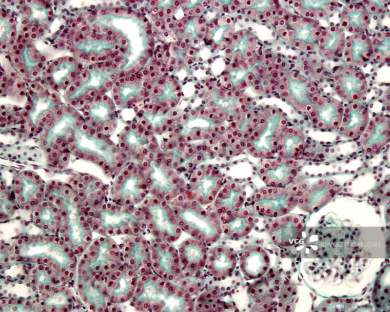 马森染色肾脏组织光学显微照片图片素材