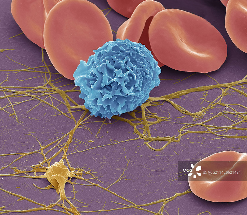 血细胞扫描电镜图图片素材