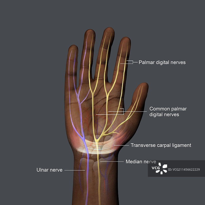 腕管综合征插图图片素材