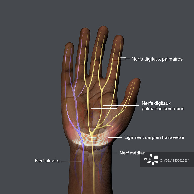腕管综合征插图图片素材