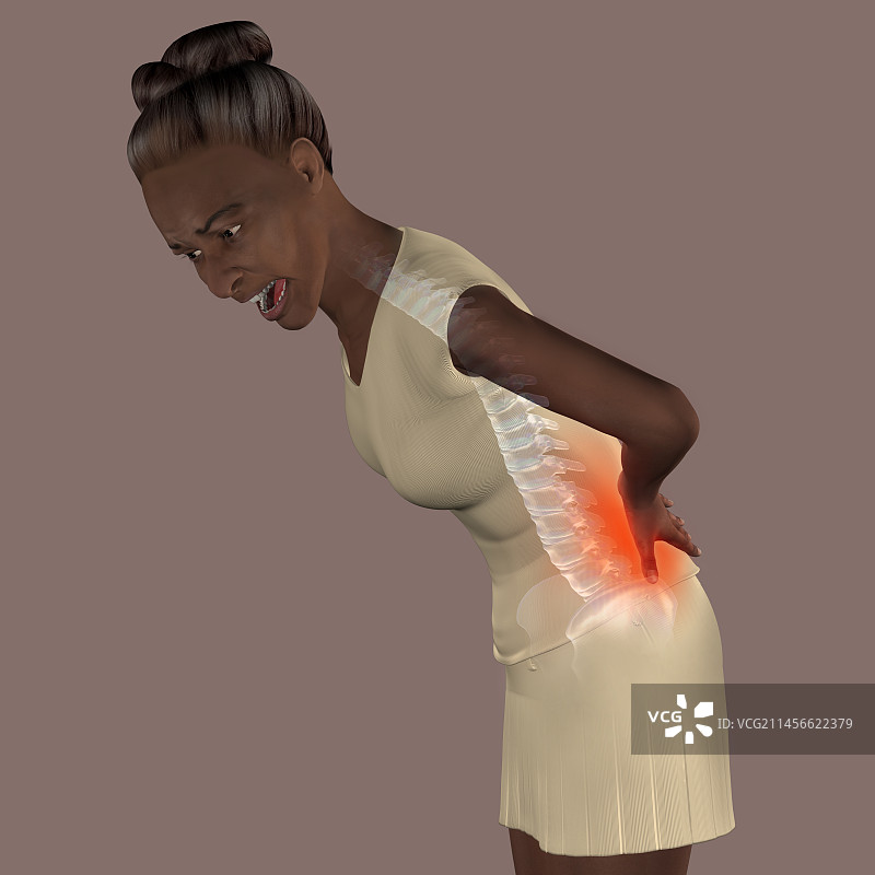 患有下背痛的女人，插图图片素材