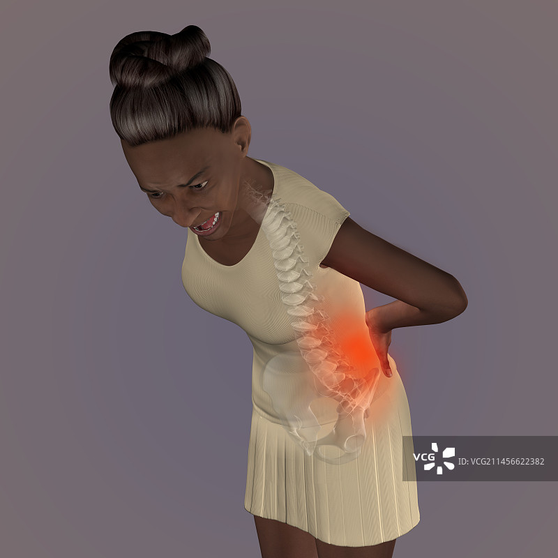 患有下背痛的女人，插图图片素材