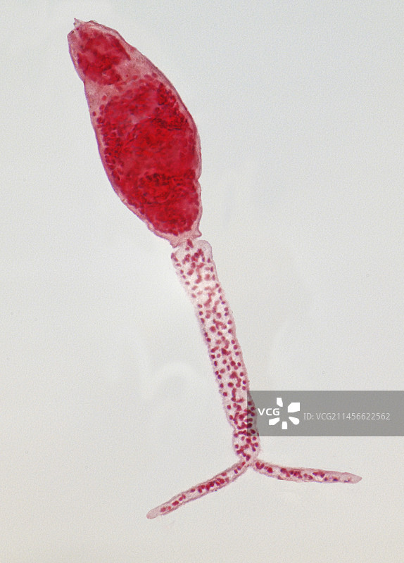 血吸虫幼虫，LM图片素材