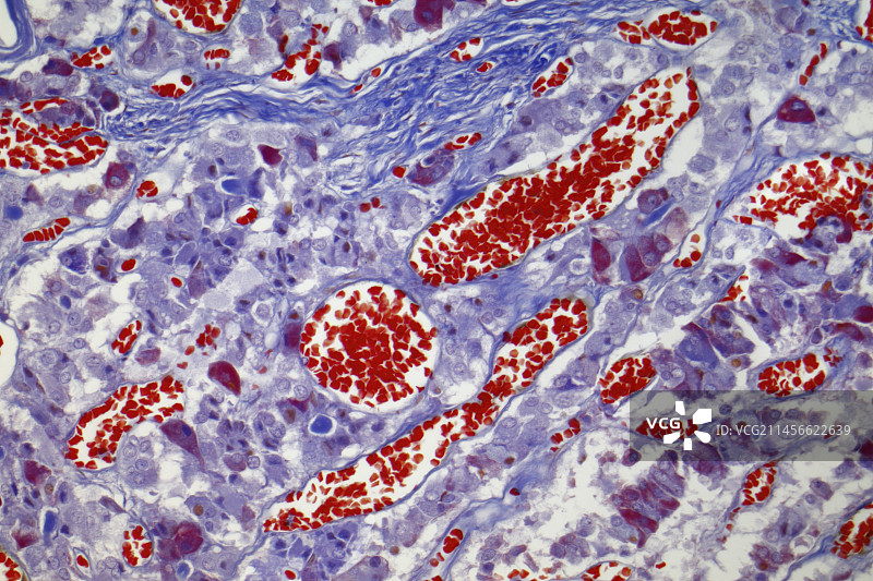 垂体血管，LM图片素材