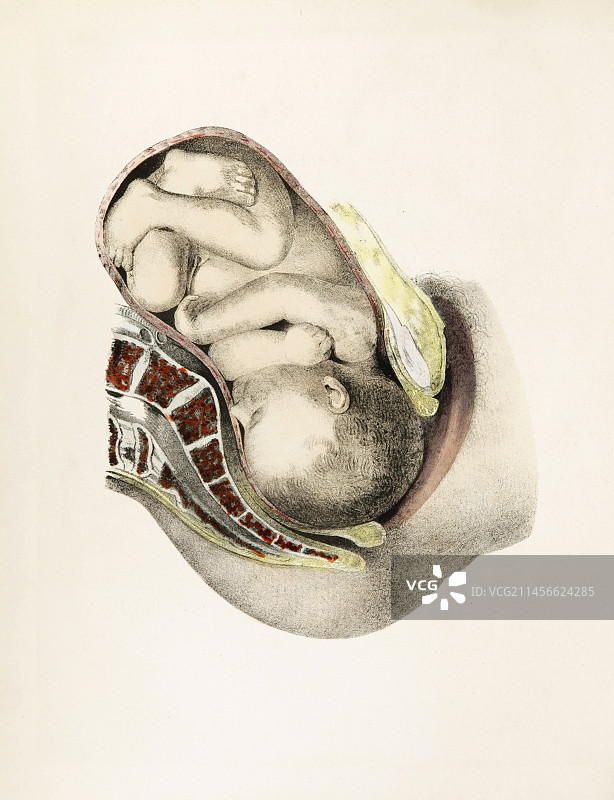 19世纪分娩插图图片素材