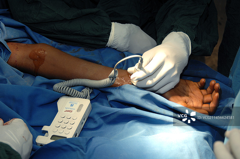 外科医生检查脉搏图片素材