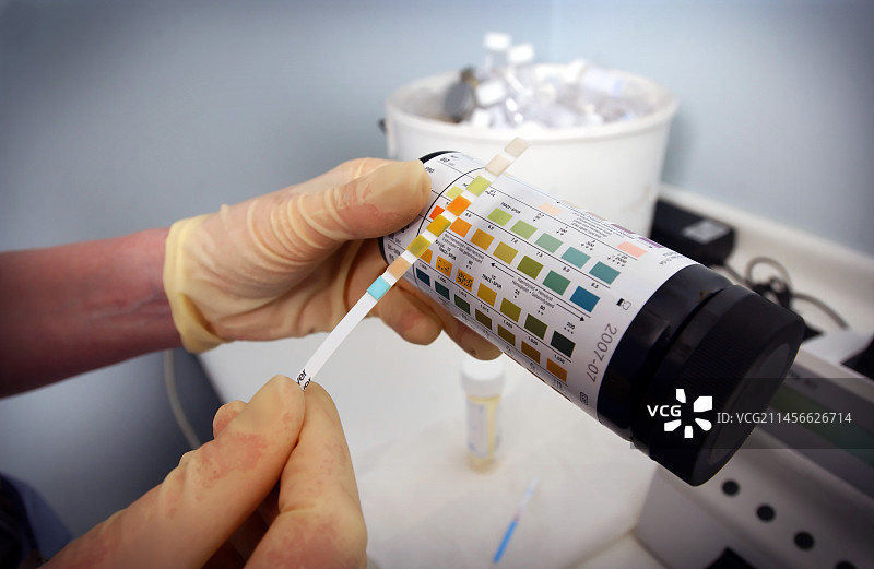 尿液分析图片素材