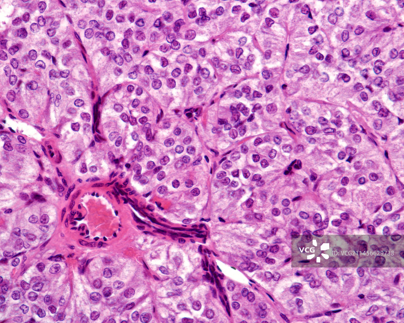 人肾上腺髓质显微照片图片素材