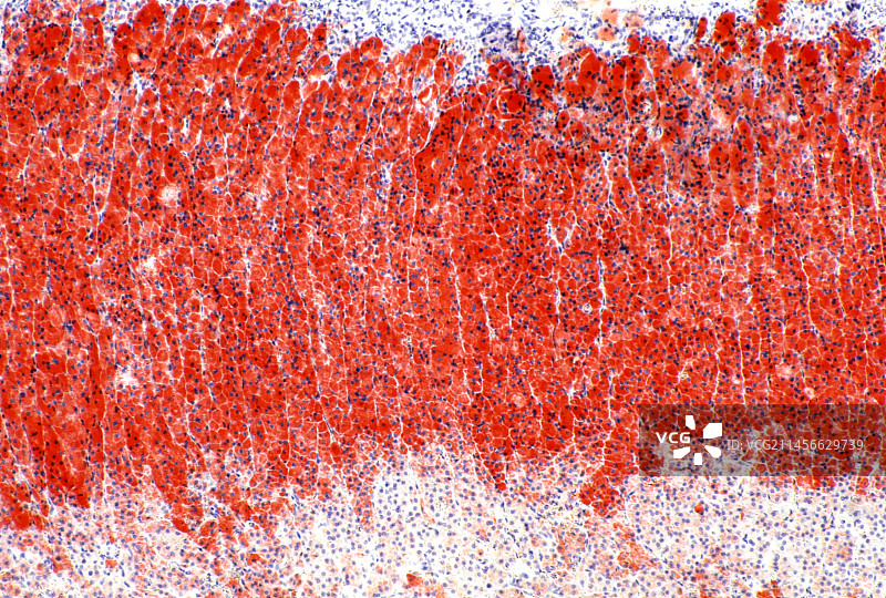 肾上腺光学显微照片图片素材