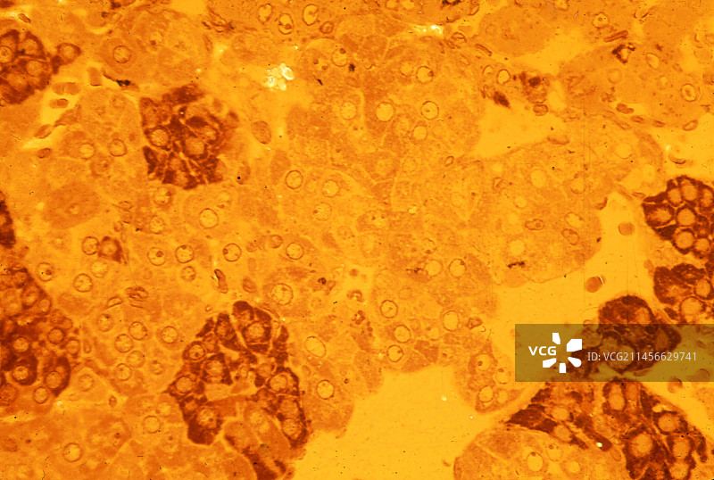 肾上腺髓质显微照片图片素材