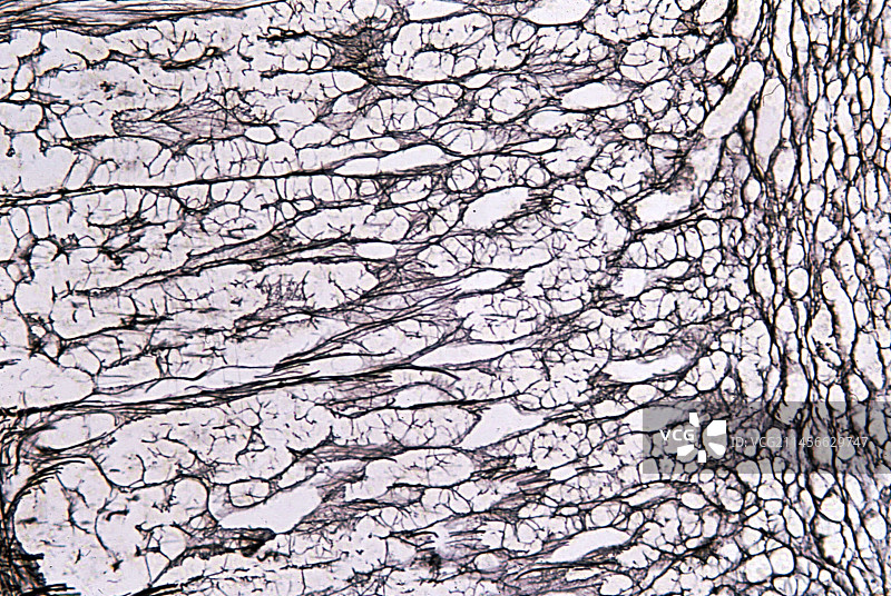 人类肾上腺皮质显微照片图片素材