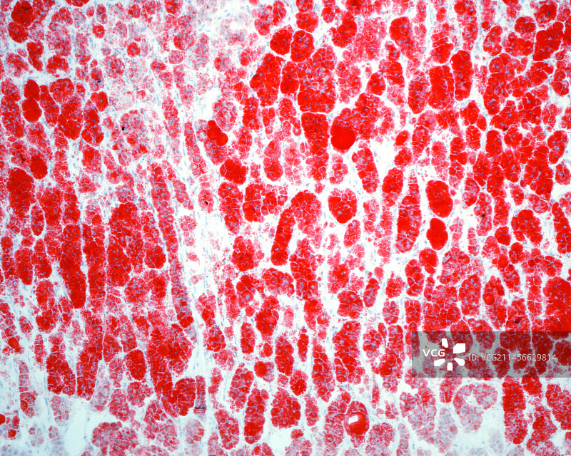 肾上腺皮质显微照片图片素材