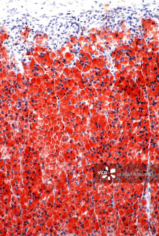 肾上腺皮质显微照片图片素材