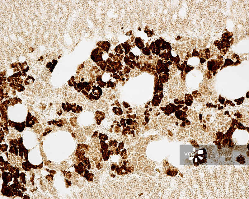 肾上腺髓质显微照片图片素材