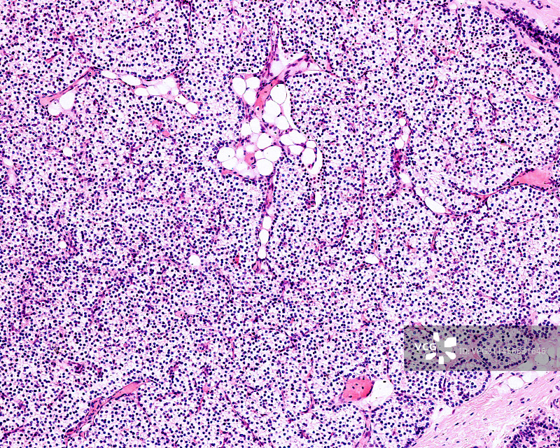 儿童的甲状旁腺，光学显微照片图片素材