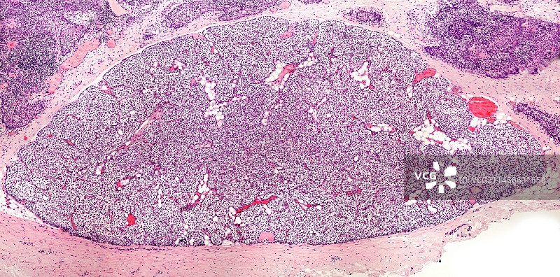 甲状旁腺显微照片图片素材