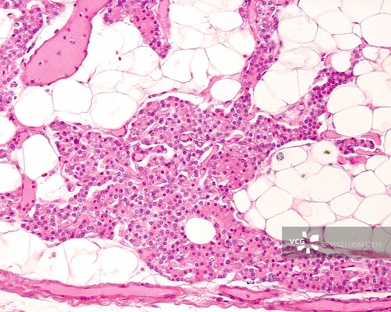 成年甲状旁腺，光学显微照片图片素材