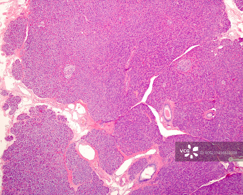 胰腺光学显微照片图片素材