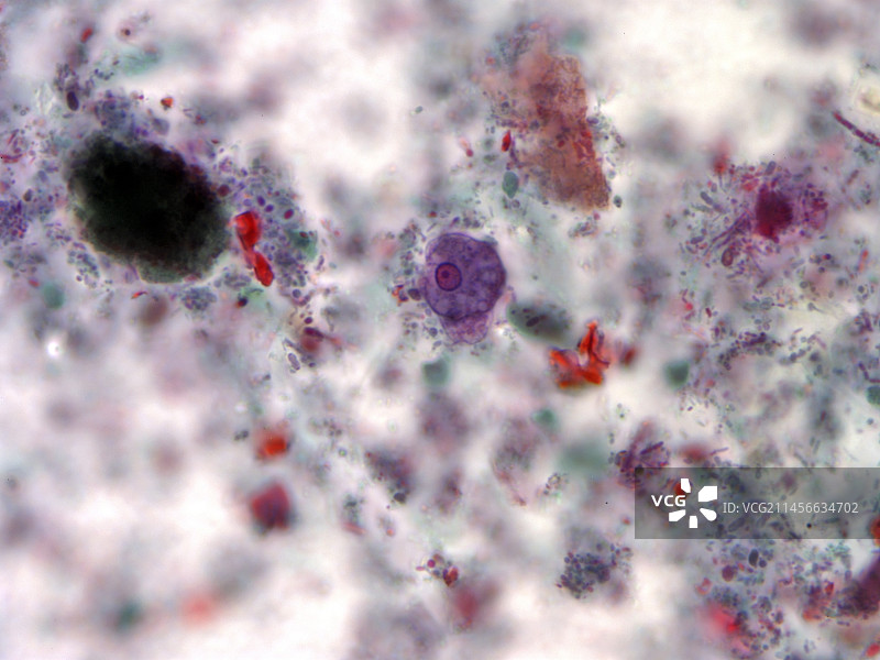 溶组织内阿米巴滋养体，光学显微照片图片素材