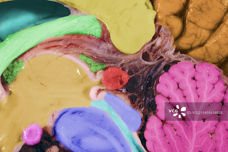 人脑的松果体及邻近结构图片素材