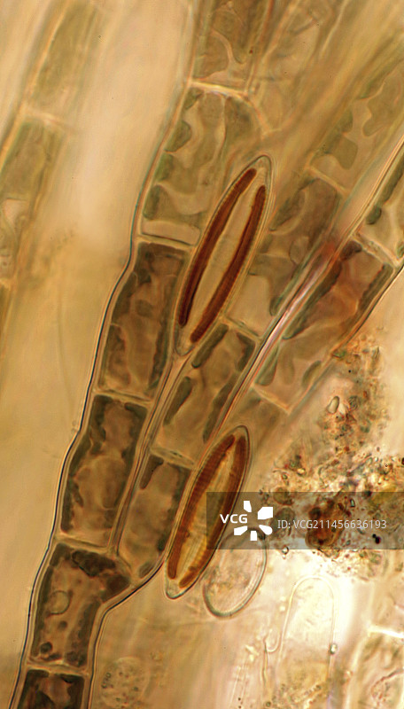 奥杜因藻属红藻与硅藻光学显微照片图片素材