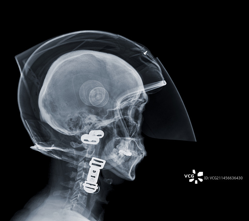 戴摩托车头盔的人的X光片图片素材