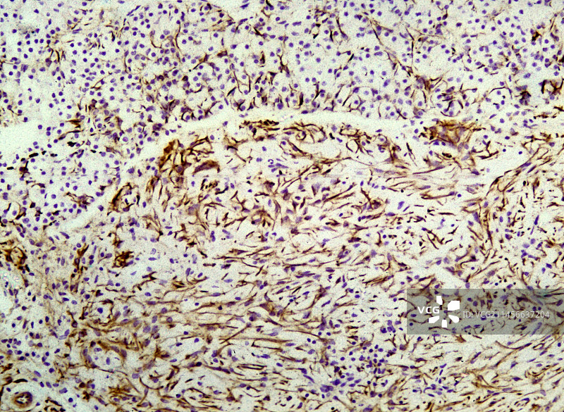 脑垂体，光学显微照片图片素材