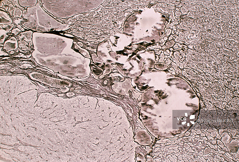 人脑垂体中的网状纤维，光学显微照片图片素材