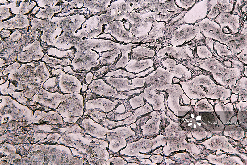 人脑垂体中的网状纤维，光学显微照片图片素材