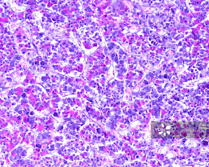 垂体前叶的光学显微照片图片素材