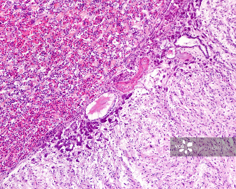 脑垂体中间叶的光学显微照片图片素材