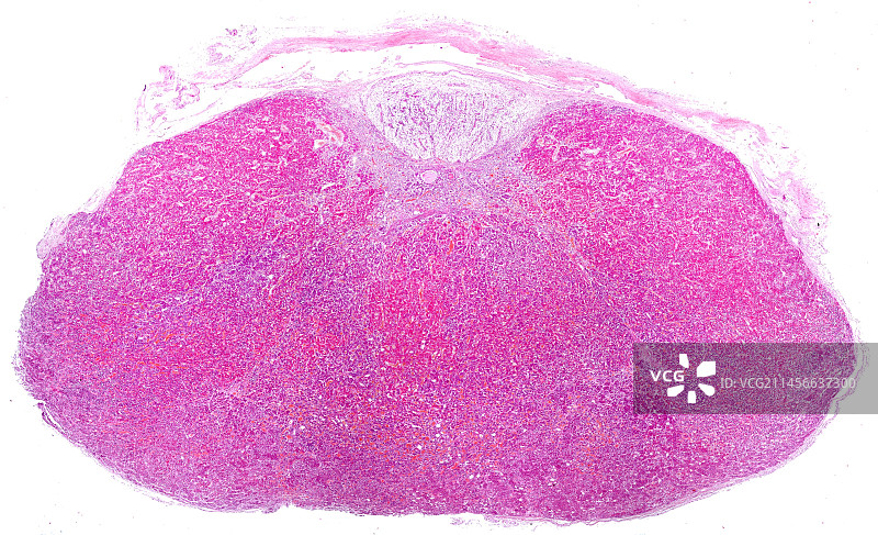 人体脑垂体显微照片图片素材