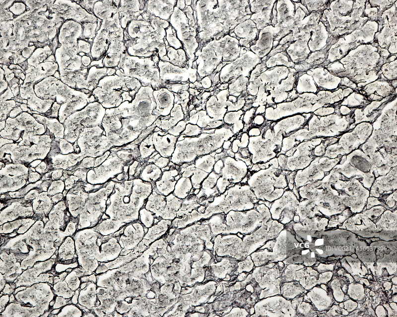 人脑垂体中的网状纤维，光学显微照片图片素材