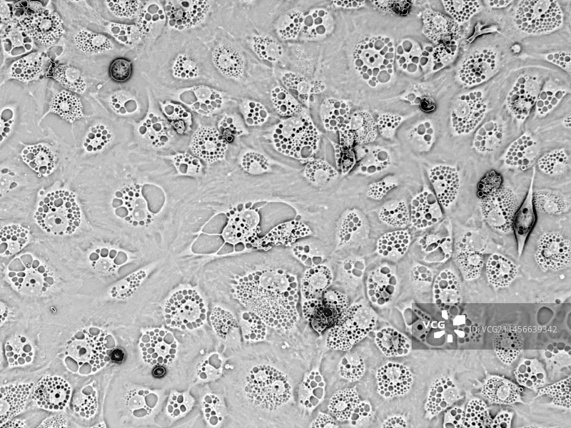 具有增大溶酶体的成纤维细胞（光学显微镜）图片素材