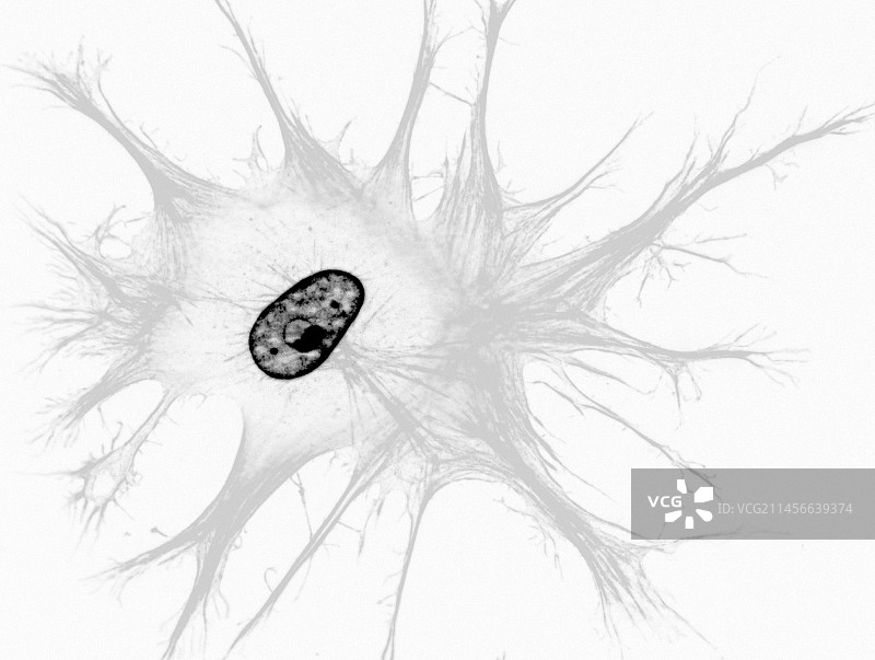 成纤维细胞，荧光显微照片图片素材