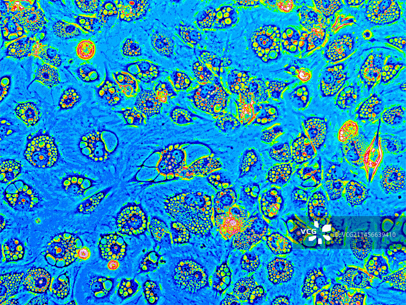 成纤维细胞热图，光学显微照片图片素材