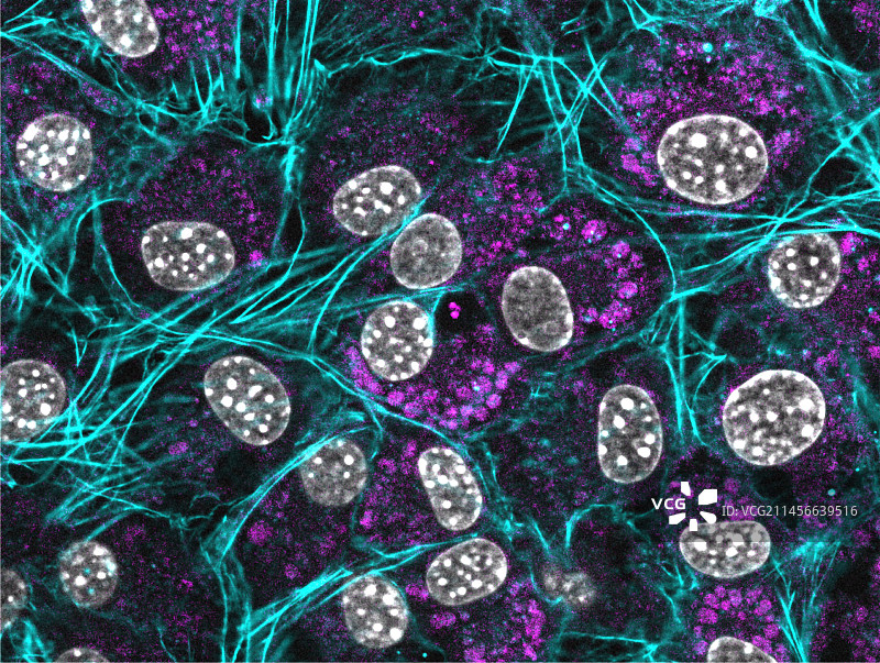 成纤维细胞荧光显微照片图片素材