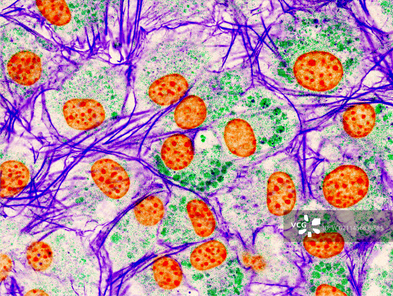 成纤维细胞荧光显微照片图片素材