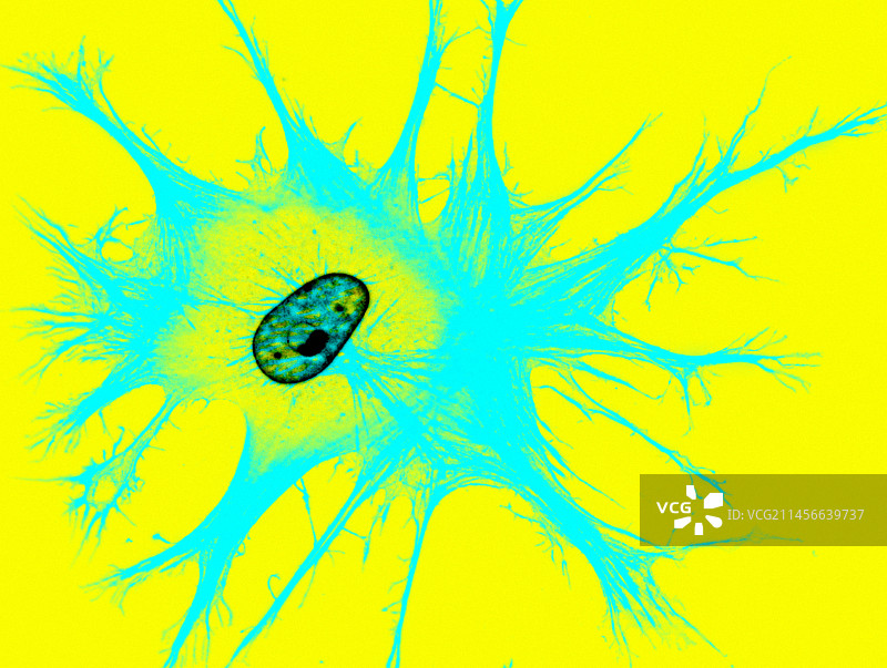 成纤维细胞，荧光显微照片图片素材