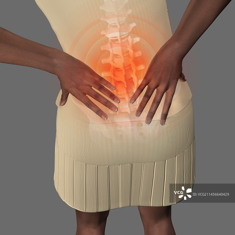 腰背疼痛图图片素材