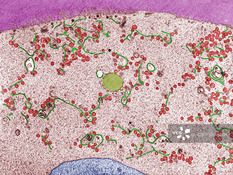卵母细胞和透明带，TEM图片素材