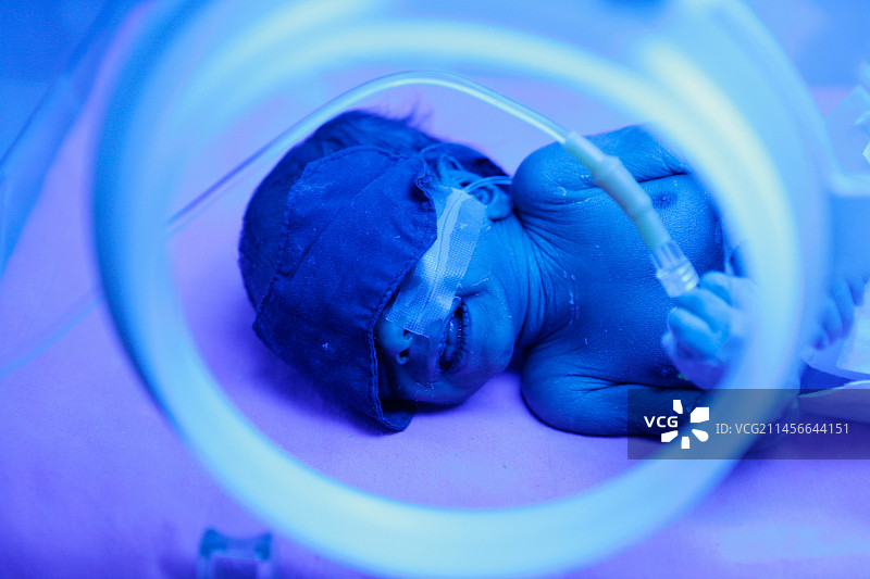 保温箱中的早产儿图片素材