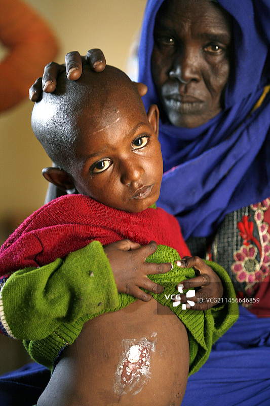 患有麻风病的男孩图片素材