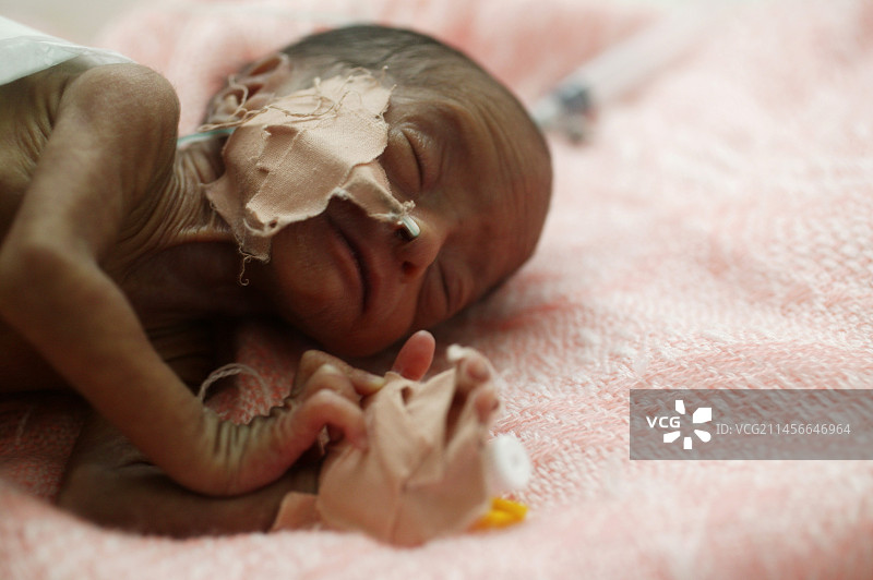 早产儿图片素材