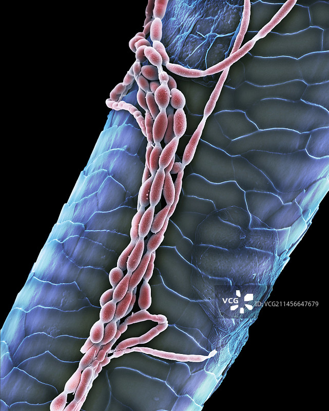 睫毛真菌感染图片素材